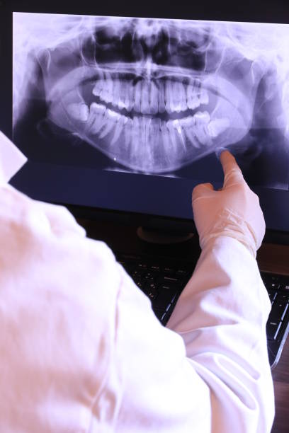 Best Emergency Dentist for Knocked-Out Tooth in Petersburg, IL