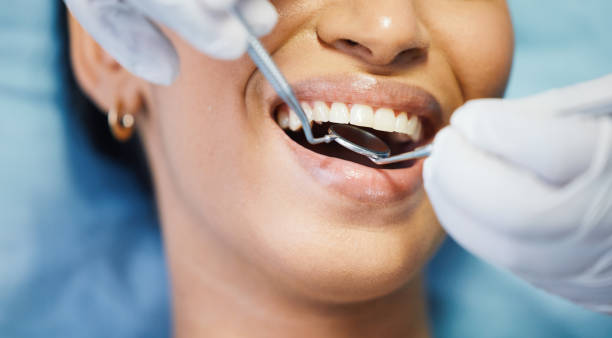 Best Emergency Dental Services for Seniors in Petersburg, IL