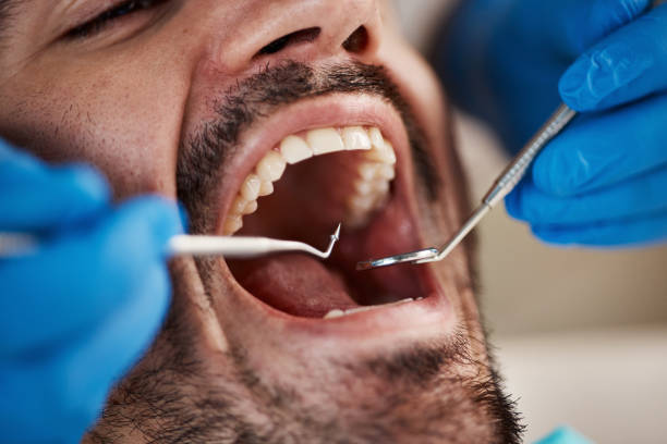 Best Holiday Emergency Dentist in Petersburg, IL