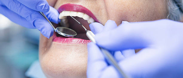 Best Emergency Dental Care for Abscessed Tooth in Petersburg, IL